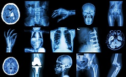 medmantra-artificial-intelligence-ai-7